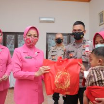 Bhayangkari Daerah Lampung Gelar Bhakti Kesehatan Operasi Celah Bibir Sumbing Dalam Rangka HKGB Ke-70